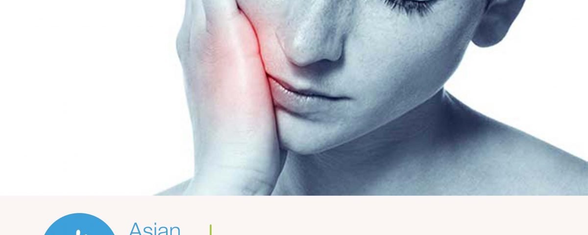 Trigeminal Neuralg