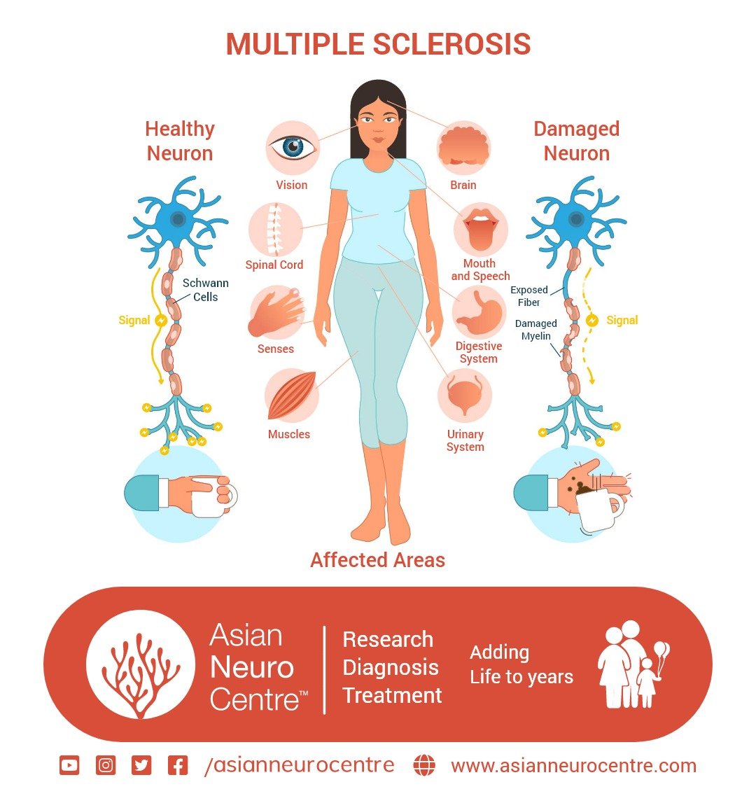 Symptoms of Multiple Sclerosis