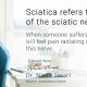 Best treatment of sciatica in Indore