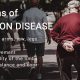 treatment of Parkinson's disease