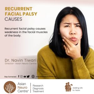 Recurrent Facial Palsy Causes, Bell's Palsy Treatment in Indore