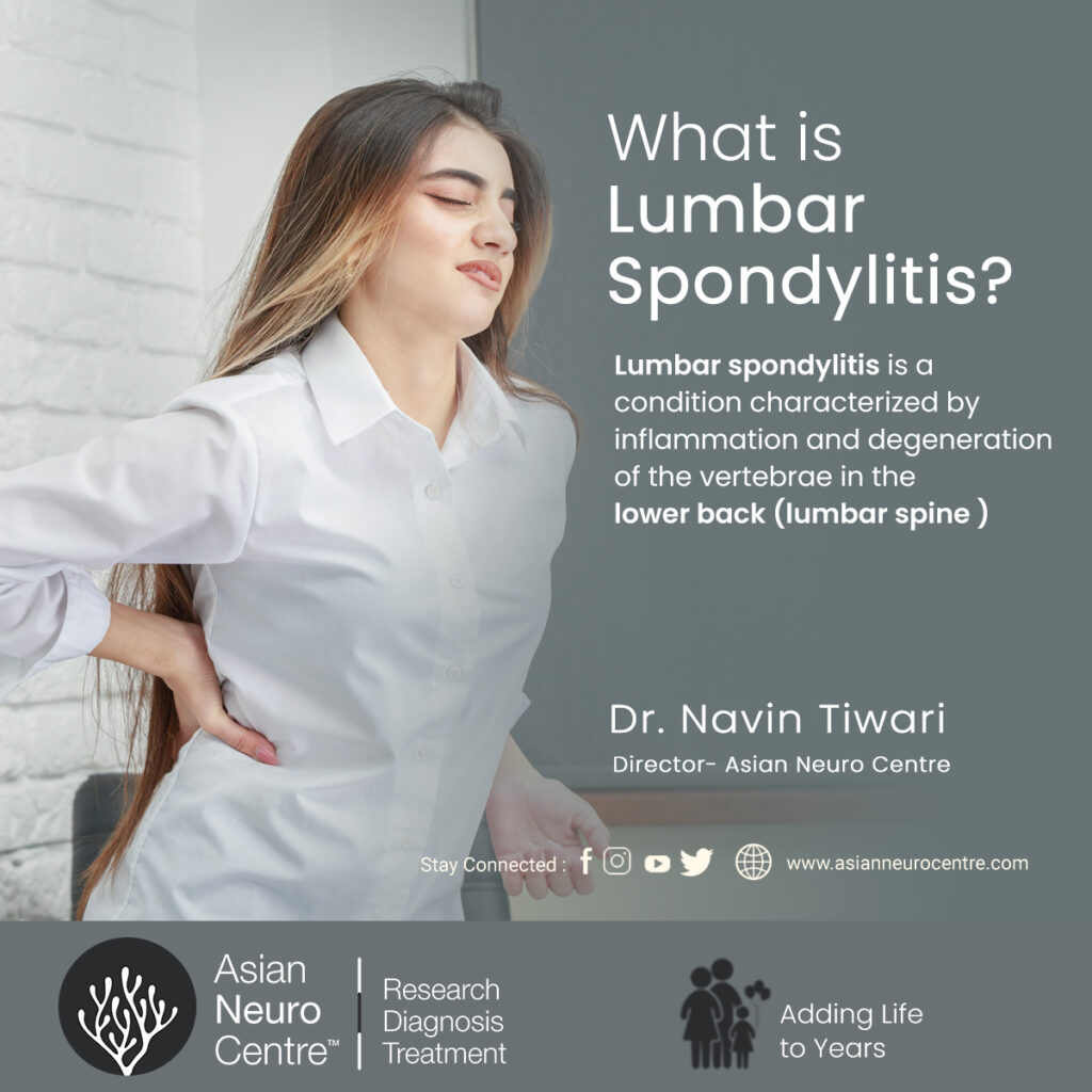 What is Lumbar Spondylitis?,Symptoms, Causes, Treatment & More