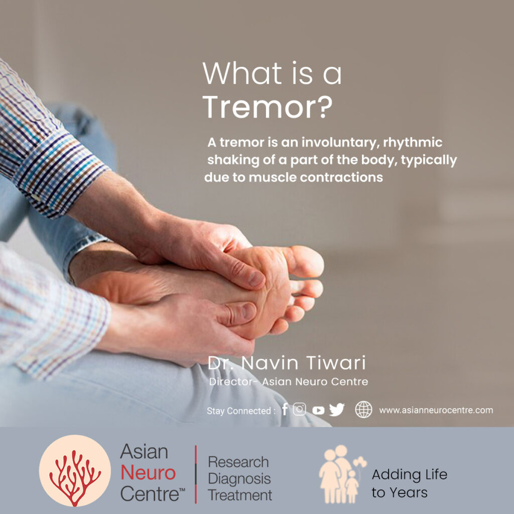 What is a Tremor?, Symptoms, Causes, Treatment & More
