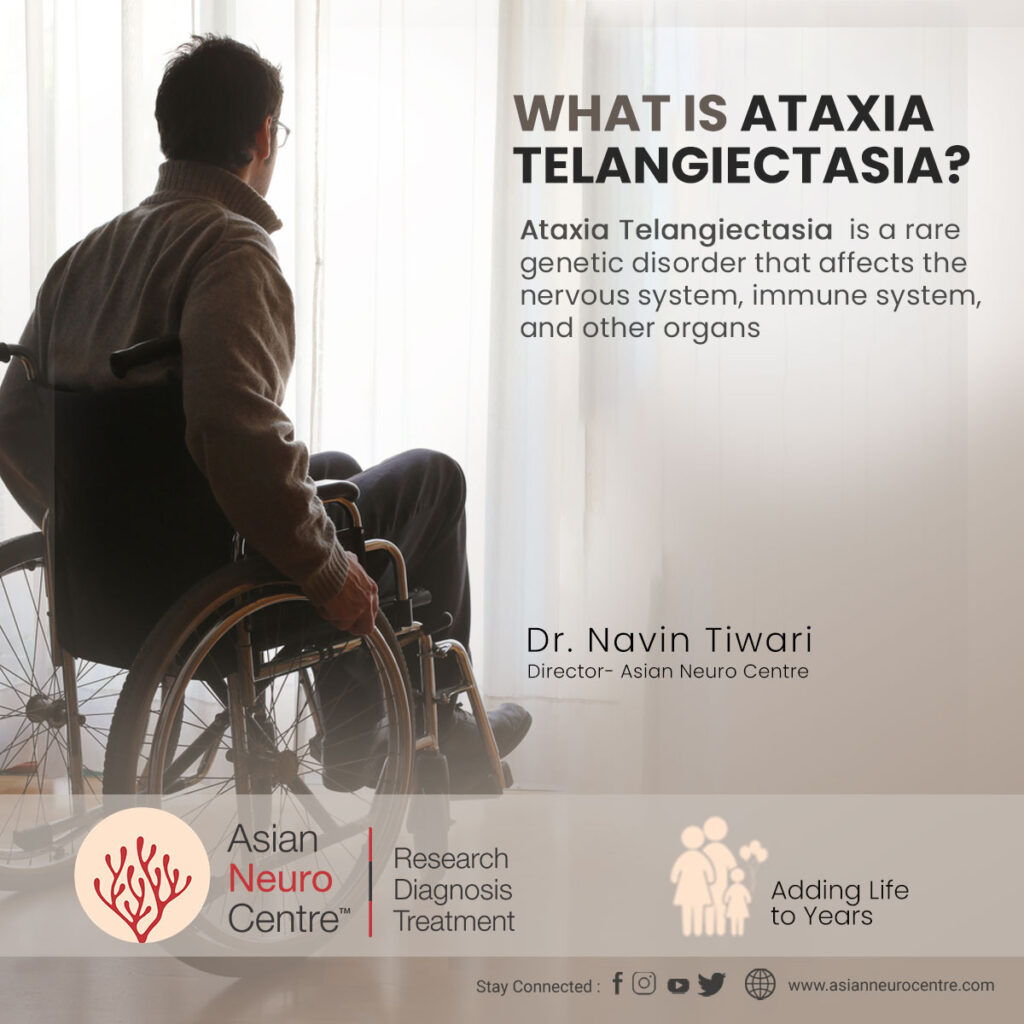 What is Ataxia Telangiectasia?, Symptoms, Causes, Treatment 