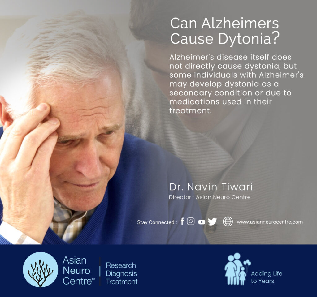 Can Alzheimers Cause Dystonia?
