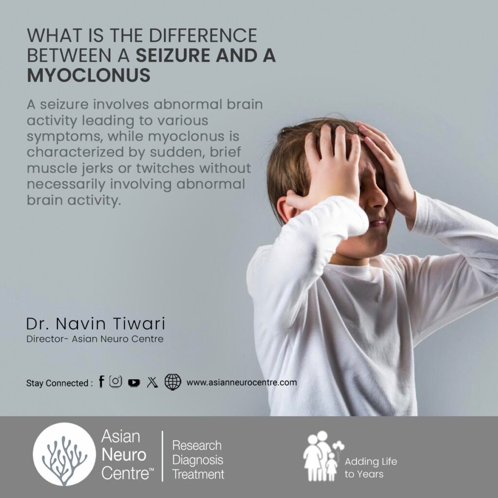 What is the Difference Between a Seizure and a Myoclonus?