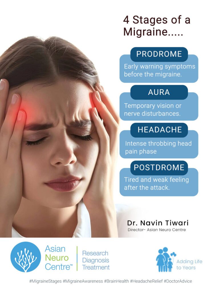 What are the stages of a migraine? | Migraine treatment in Indore 
